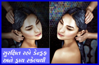 સુરક્ષિત રહો ડેન્ડ્રફ અને ડ્રાય સ્કેલ્પથી